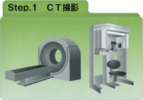 ｉＣＡＴインプラント